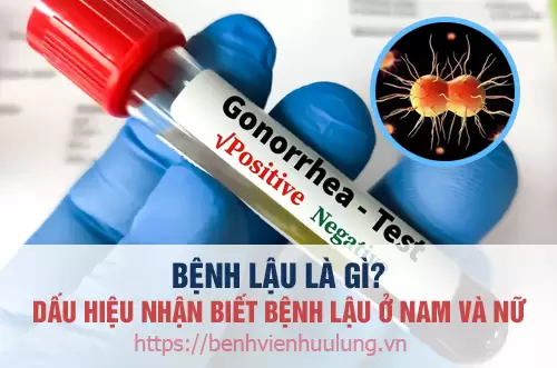 Tổng quan về bệnh lậu ở nam giới như thế nào và cách điều trị