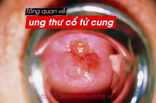 6. Phác đồ điều trị và tiên lượng