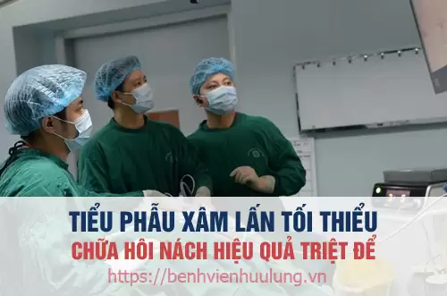 Phương pháp điều trị hôi nách triệt để bằng kỹ thuật xâm lấn tối thiểu tại phòng khám Thái Hà
