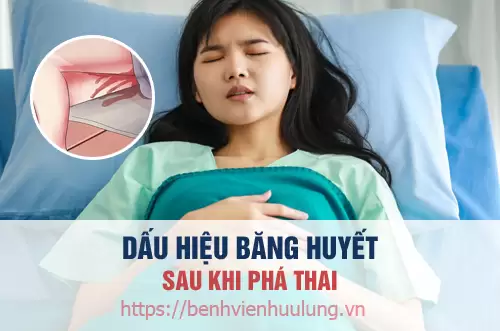 Hướng dẫn xử lý băng huyết sau phá thai